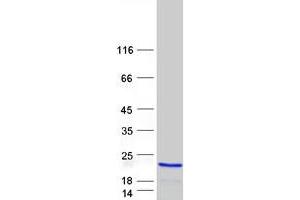Western Blotting (WB) image for Prefoldin Subunit 2 (PFDN2) protein (Myc-DYKDDDDK Tag) (ABIN2728723)