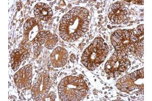 Immunohistochemistry (IHC) image for anti-GNAS Complex Locus (GNAS) antibody (ABIN2856886)