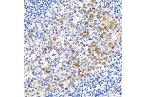 Immunohistochemistry of paraffin-embedded human placenta using Phospho--S473 Rabbit mAb (ABIN6135179, ABIN6135970, ABIN6135971 and ABIN7101880) at dilution of 1:100 (40x lens). (AKT1 Antikörper  (pSer473))