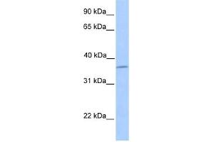 LAYN antibody used at 1 ug/ml to detect target protein. (Layilin Antikörper  (N-Term))