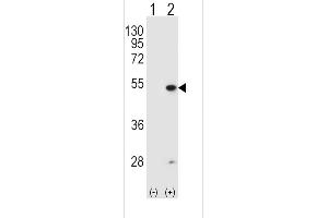 Western blot analysis of FDFT1 (arrow) using rabbit polyclonal FDFT1 Antibody (E11) (ABIN389051 and ABIN2839260). (FDFT1 Antikörper  (N-Term))