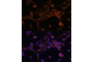 Immunofluorescence (IF) image for anti-Eukaryotic Translation Initiation Factor 2B, Subunit 2 Beta, 39kDa (EIF2B2) (AA 1-351) antibody (ABIN6140037)
