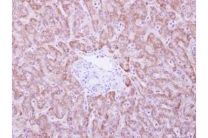 IHC-P Image ANKRD45 antibody detects ANKRD45 protein at cytosol on human normal liver by immunohistochemical analysis. (ANKRD45 Antikörper)