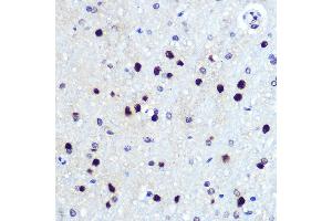 Immunohistochemistry of paraffin-embedded rat brain using HES1 Rabbit mAb (ABIN7267624) at dilution of 1:100 (40x lens). (HES1 Antikörper)