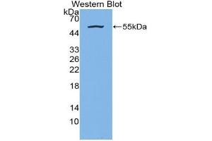 Western blot analysis of the recombinant protein. (Kallikrein 7 Antikörper  (AA 24-255))