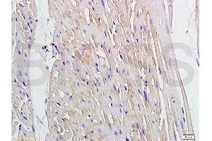 Formalin-fixed and paraffin embedded rat heart labeled with Anti Connexin-37/GJA4 Polyclonal Antibody, Unconjugated  at 1:200 followed by conjugation to the secondary antibody and DAB staining (GJA4 Antikörper  (AA 151-250))