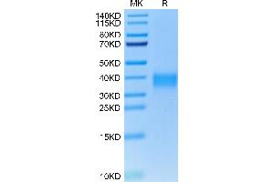 Cynomolgus TNFR1 on Tris-Bis PAGE under reduced condition. (TNFRSF1A Protein (AA 30-211) (His tag))