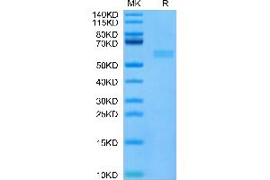 SDS-PAGE (SDS) image for Fibroblast Growth Factor 21 (FGF21) (AA 29-209) protein (His tag) (ABIN7274610)