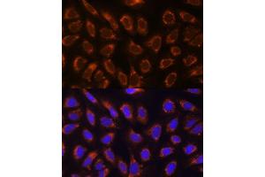 Immunofluorescence analysis of U-2 OS cells using GANAB antibody  at dilution of 1:100. (GANAB Antikörper  (AA 1-260))