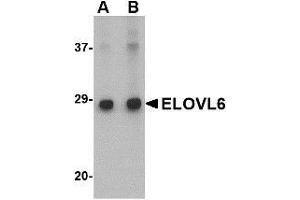 Western blot analysis of ELOVL6 in Human brain tissue lysate with ELOVL6 antibody at (A) 1 and (B) 2 μg/ml. (ELOVL6 Antikörper  (N-Term))