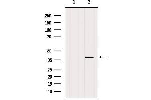 Western blot analysis of extracts from VERO, using LT4R1 Antibody.