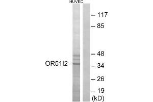 Western blot analysis of extracts from HUVEC cells, using OR51I2 antibody. (OR51I2 Antikörper  (Internal Region))