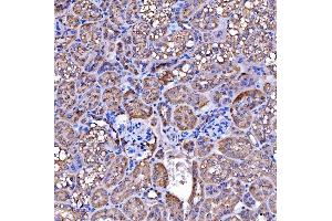 IHC analysis of SUCLG2 using anti-SUCLG2 antibody (ABIN7601694). (SUCLG2 Antikörper  (AA 42-424))