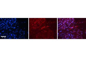 Rabbit Anti-EWSR1 Antibody   Formalin Fixed Paraffin Embedded Tissue: Human Testis Tissue Observed Staining: Cytoplasm, nucleus and plasma membrane in spermatogonia, spermatocytes and smooth muscle cells Primary Antibody Concentration: 1:100 Other Working Concentrations: 1:600 Secondary Antibody: Donkey anti-Rabbit-Cy3 Secondary Antibody Concentration: 1:200 Magnification: 20X Exposure Time: 0.