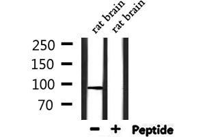 Western blot analysis of extracts from rat brain, using TRPV4 Antibody. (TRPV4 Antikörper  (C-Term))