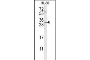 EMX2 Antibody (Center) (ABIN651733 and ABIN2840380) western blot analysis in HL-60 cell line lysates (15 μg/lane). (EMX2 Antikörper  (AA 111-138))