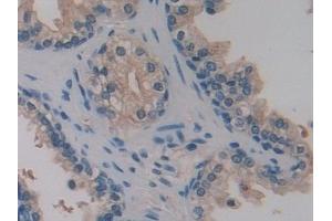 Detection of PTI in Human Prostate Tissue using Polyclonal Antibody to Placental Thrombin Inhibitor (PTI) (SERPINB6 Antikörper  (AA 1-376))