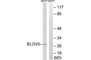 Western blot analysis of extracts from MCF-7 cells, using ELOVL5 Antibody. (ELOVL5 Antikörper  (AA 250-299))