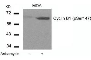 Western blot analysis of extracts from MDA cells untreated or treated with Anisomycin using Cyclin B1(phospho-Ser147) Antibody. (Cyclin B1 Antikörper  (pSer147))