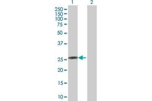 Western Blot analysis of KCNIP4 expression in transfected 293T cell line by KCNIP4 MaxPab polyclonal antibody. (KCNIP4 Antikörper  (AA 1-250))