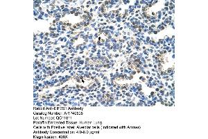 Rabbit Anti-EIF2S1 Antibody  Paraffin Embedded Tissue: Human Lung Cellular Data: Alveolar cells Antibody Concentration: 4. (EIF2S1 Antikörper  (C-Term))