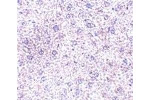 Immunohistochemistry (IHC) image for anti-Plexin Domain Containing 1 (PLXDC1) (C-Term) antibody (ABIN1030730) (PLXDC1 Antikörper  (C-Term))
