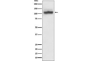 Western blot analysis of SERCA2 expression in HeLa cell lysate.