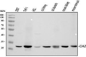 Western blot analysis of CA2 using anti-CA2 antibody (ABIN4886493). (CA2 Antikörper  (AA 2-260))