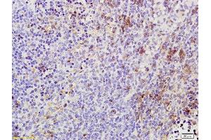 Formalin-fixed and paraffin embedded rat spleen labeled with Rabbit Anti Phospho-TAK1(Thr184/187) Polyclonal Antibody, Unconjugated (ABIN746348) at 1:200 followed by conjugation to the secondary antibody and DAB staining (TR4 Antikörper  (pThr184, pThr187))