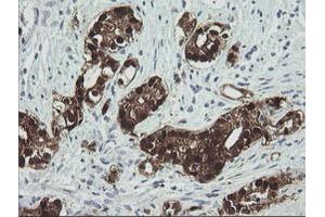 Image no. 4 for anti-Cytidine Monophosphate (UMP-CMP) Kinase 1, Cytosolic (CMPK1) antibody (ABIN1497544) (Cytidine Monophosphate (UMP-CMP) Kinase 1, Cytosolic (CMPK1) Antikörper)