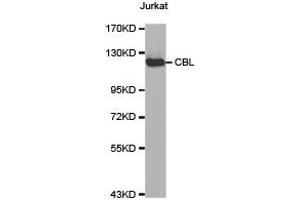 Western Blotting (WB) image for anti-Cas-Br-M (Murine) Ecotropic Retroviral Transforming Sequence (CBL) antibody (ABIN1871485)