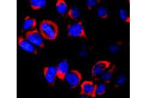 Immunofluorescence staining of vesicles (red) in RBL-2H3 (rat basophilic leukemia cell line) using Kinesin (heavy chain) monoclonal antibody, clone KN-02 . (Kinesin (heavy chain) Antikörper)