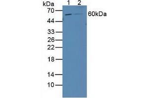 Western blot analysis of (1) Human 293T Cells and (2) Human HepG2 Cells. (Retinoic Acid Receptor beta Antikörper  (AA 205-451))