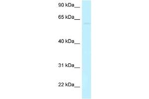 WB Suggested Anti-CCDC105 Antibody Titration: 1. (CCDC105 Antikörper  (C-Term))