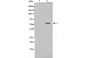 Western blot analysis on 293 cell lysate using THR1 Antibody (THRB Antikörper  (Internal Region))