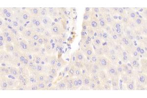 Detection of ABCC6 in Mouse Liver Tissue using Polyclonal Antibody to ATP Binding Cassette Transporter C6 (ABCC6) (ABCC6 Antikörper  (AA 1260-1498))