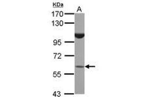 Image no. 1 for anti-BTB (POZ) Domain Containing 16 (BTBD16) (AA 1-255) antibody (ABIN1496968) (BTBD16 Antikörper  (AA 1-255))