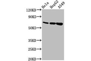 Western Blot Positive WB detected in: Hela whole cell lysate, HepG2 whole cell lysate, A549 whole cell lysate All lanes: MUC20 antibody at 5. (MUC2 Antikörper  (AA 569-657))