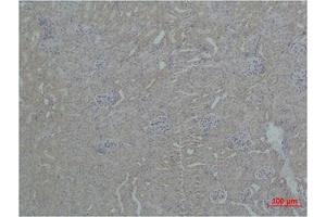 Immunohistochemistry (IHC) analysis of paraffin-embedded Mouse Kidney Tissue using ZBTB45 Polyclonal Antibody. (ZBTB45 Antikörper)