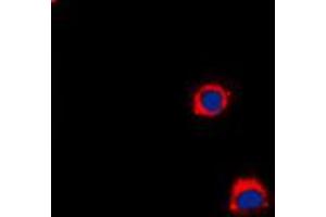 Immunofluorescent analysis of CD40 staining in A431 cells. (CD40 Antikörper  (C-Term))