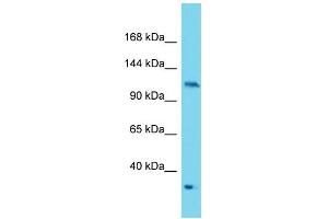 Western Blotting (WB) image for anti-Protein Kinase N2 (PKN2) (C-Term) antibody (ABIN2788942) (PKN2 Antikörper  (C-Term))