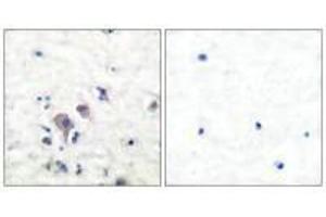 Immunohistochemical analysis of paraffin-embedded human brain tissue using GluR2/3 antibody. (Metabotropic Glutamate Receptor 3 Antikörper)