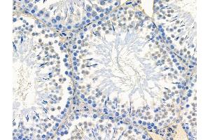 ABIN7094569 and ABIN7098618 at 1/100 staining Rat testis tissue by IHC-P. (Spt6 Antikörper  (C-Term))