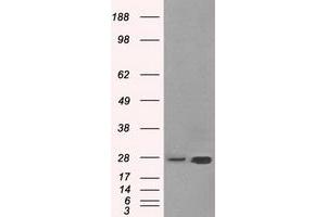 Image no. 2 for anti-Hydroxysteroid (17-Beta) Dehydrogenase 10 (HSD17B10) antibody (ABIN1498723)