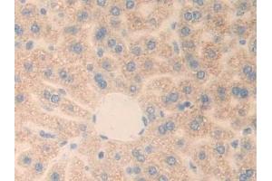 Detection of PLXNB1 in Mouse Liver Tissue using Polyclonal Antibody to Plexin B1 (PLXNB1) (PLXNB1 Antikörper  (AA 1598-1849))