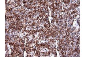 Immunohistochemistry (IHC) image for anti-T-cell surface glycoprotein CD1c (CD1C) antibody (ABIN2670659) (CD1c Antikörper)