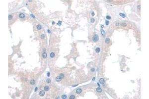 Detection of KATNA1 in Human Kidney Tissue using Polyclonal Antibody to Katanin P60 Subunit A 1 (KATNA1) (KATNA1 Antikörper  (AA 8-229))
