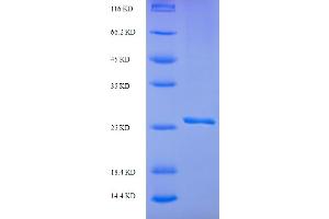 SDS-PAGE (SDS) image for Small Ubiquitin Related Modifier Protein 1 (SUMO1) (AA 2-98) protein (His-SUMO Tag) (ABIN5711265) (SUMO1 Protein (AA 2-98) (His-SUMO Tag))