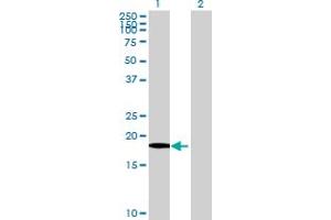 Western Blot analysis of XG expression in transfected 293T cell line by XG MaxPab polyclonal antibody. (Glycoprotein Xg Antikörper  (AA 1-181))