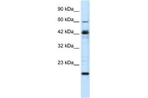 WB Suggested Anti-ZNF24 Antibody Titration:  0. (ZNF24 Antikörper  (Middle Region))